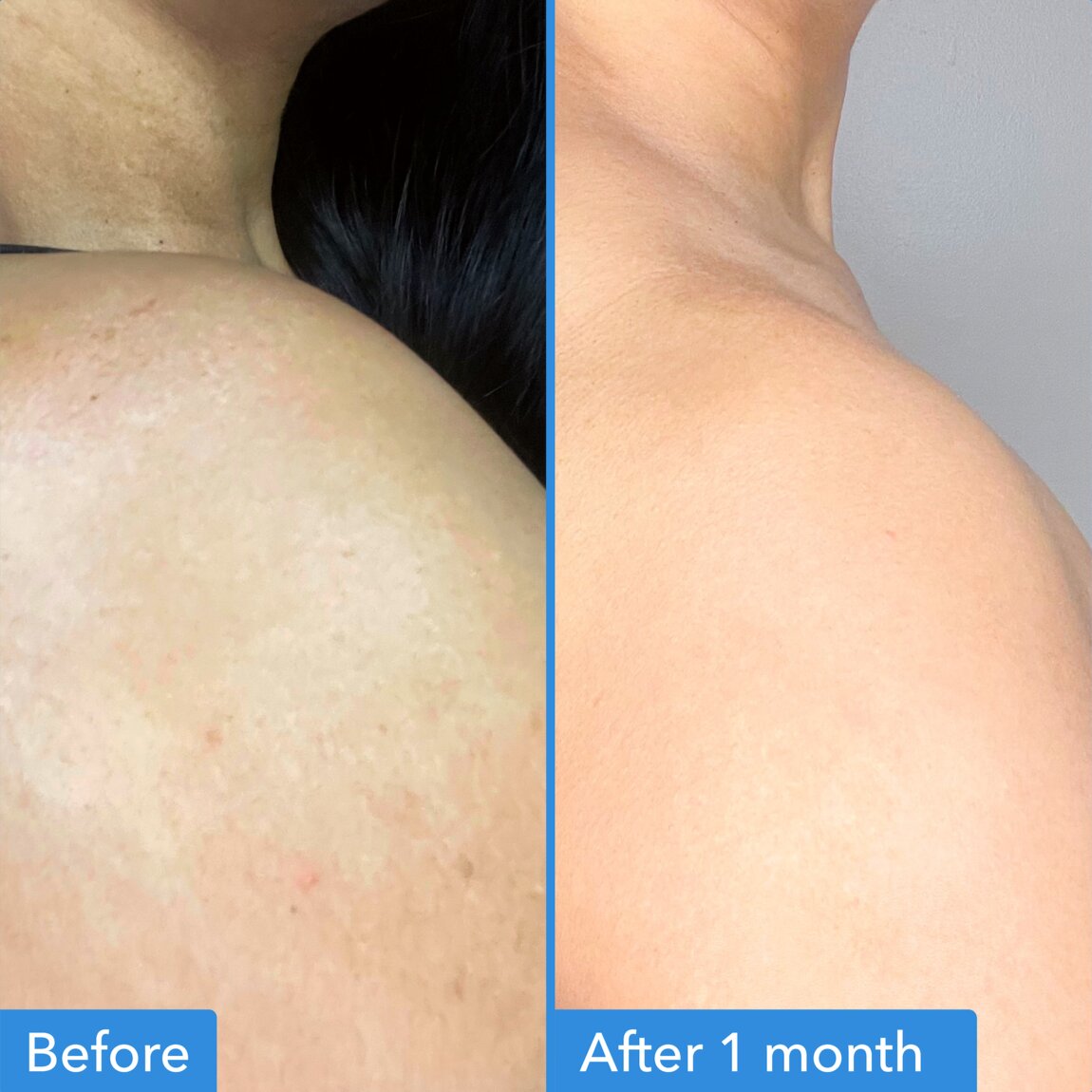 discoloration-correcting-body-treatment-a5 zb_p.jpg