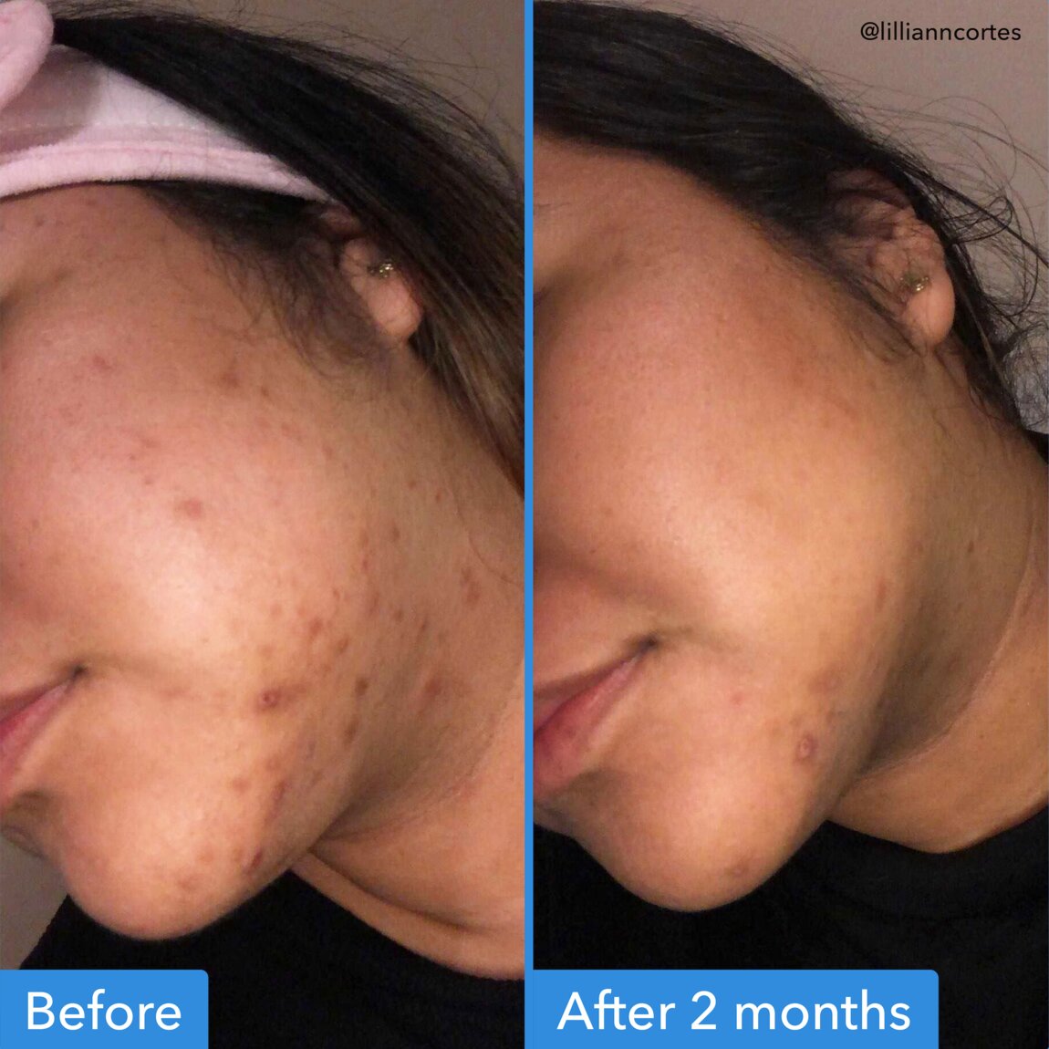 discoloration-correcting-serum-m6 zb_p.jpg